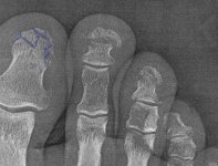 toes.jpg