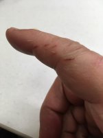 finger.jpg